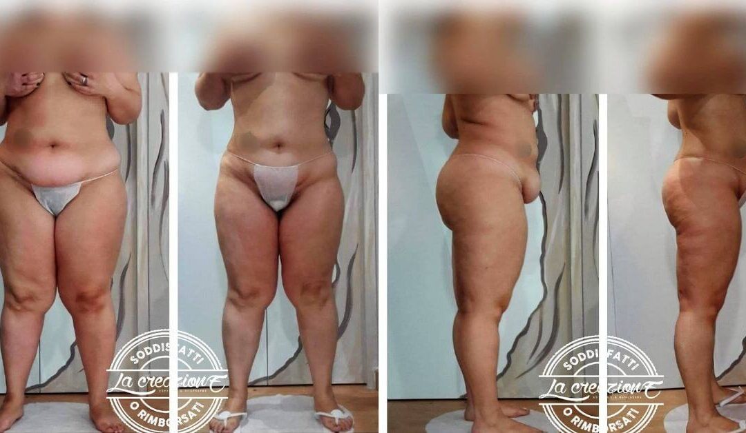 Rachele perde 10 chili, ma sembrano 20