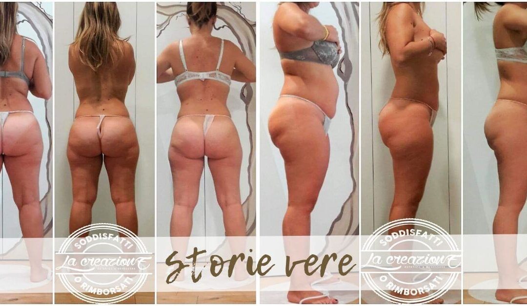 etodo BootyUp Prima e Dopo - La Creazione Tolentino