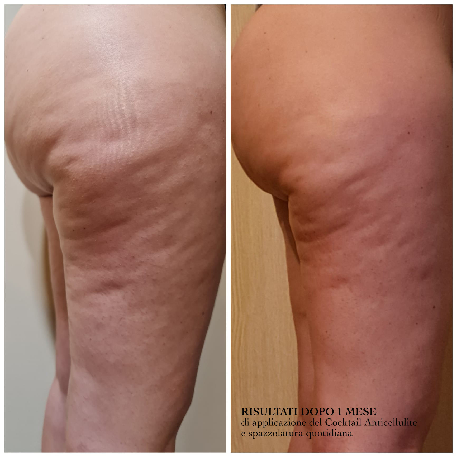 cocktail anticellulite BootyUp